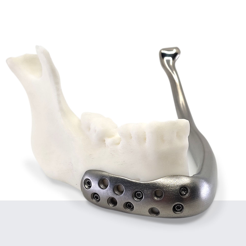 solid custom mandible