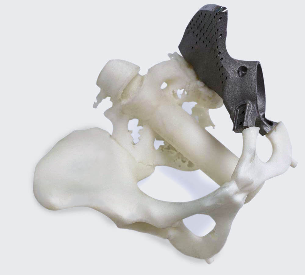 Pelvis part