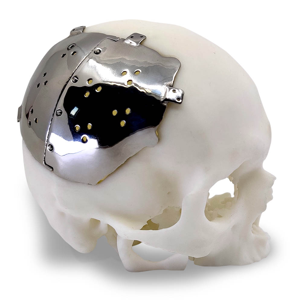 Polishing skull implant